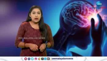 Study says by 2050, stroke deaths in the world will rise