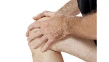 Arthritis: സന്ധി വേദനയിൽ നിന്ന് മുക്തി നേടണോ..? ഈ കാര്യങ്ങൾ ചെയ്യൂ