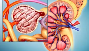 Kidney: കിഡ്‌നി പ്രശ്‌നങ്ങളുണ്ടോ...? ഈ ഭക്ഷണങ്ങളിൽ നിന്ന് വിട്ടുനിൽക്കുക...!