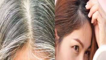 White Hair Home remedy: വെളുത്ത മുടി കറുപ്പിക്കാം, അകാലനരയ്ക്ക് പരിഹാരം അടുക്കളയില്‍ 