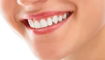 Teeth: പല്ലിലെ പ്ലാക്ക് നീക്കണോ..? ഈ വീട്ടുവൈദ്യങ്ങൾ പ്രയോ​ഗിക്കൂ