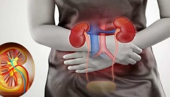 Kidney Stone Issue: വൃക്കയിലെ കല്ലുകൾ അലിയിക്കും...! ഈ ഭക്ഷണങ്ങൾ കഴിക്കൂ