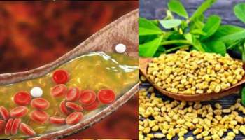 Methi Seeds For Cholesterol: ഉയർന്ന കൊളസ്‌ട്രോൾ നിയന്തിക്കാൻ ഡയറ്റിൽ ഇത് ഉൾപ്പെടുത്തൂ.. ഫലം ഉറപ്പ്!