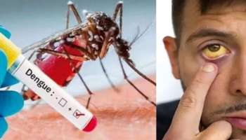 Dengue Fever Alert: ചൂടിന് ശമനം നൽകി വേനൽമഴ; എന്നാൽ, ഡെങ്കിപ്പനിയും മഞ്ഞപ്പിത്തവും വെല്ലുവിളി, മുൻകരുതൽ വേണമെന്ന് ആരോ​ഗ്യവകുപ്പ്