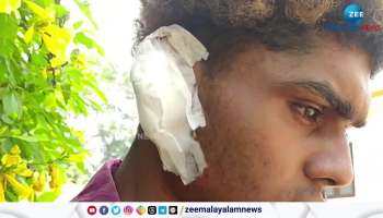 Trivandrum, Youth assaulted by anti socials bitten off his ear 