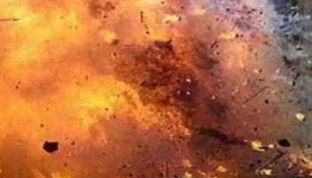Bomb Blast : തിരുവനന്തപുരത്ത് ബോംബ് നിർമാണത്തിനിടെ പൊട്ടിത്തെറി; 17കാരന്റെ കൈപ്പത്തികൾ അറ്റു