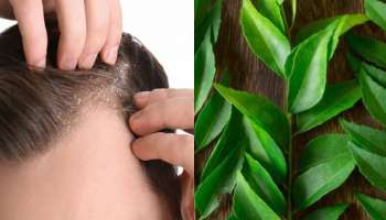 Dandruff: താരൻ കൊണ്ട് ബുദ്ധിമുട്ടുന്നുണ്ടോ? കറിവേപ്പിലയിലുണ്ട് മാജിക്!