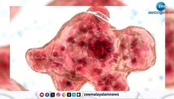 Amebic Meningoencephalitis again confirmed in kerala