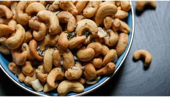 Cashew: അണ്ടിപ്പരിപ്പ് വാരി വലിച്ച് കഴിക്കല്ലേ...; ആരോഗ്യത്തിന് ഹാനീകരം