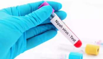 Nipah Virus: നിപയിൽ ഇതുവരെ രോഗപ്പകര്‍ച്ചയുടെ സൂചനകളില്ലെന്ന് മന്ത്രി; മാനദണ്ഡങ്ങള്‍ക്കനുസരിച്ച് നിയന്ത്രണങ്ങളില്‍ ഇളവ്