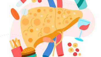 Fatty Liver: ഈ ദുശീലങ്ങൾ ഫാറ്റി ലിവറിലേക്ക് നയിക്കും; ശ്രദ്ധിക്കുക!