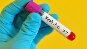 Nipah: കണ്ണൂരിൽ നിപയില്ല! നിരീക്ഷണത്തിലിരുന്ന 2 പേരുടെ പരിശോധനാ ഫലം നെ​ഗറ്റീവ്