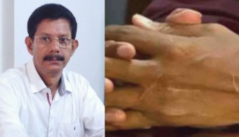 Prof TJ Joseph-Hand Chopping Case: പ്രൊഫ. ടിജെ ജോസഫിന്റെ കൈപ്പത്തി വെട്ടിയ കേസ്; മുഖ്യസൂത്രധാരന്റെ ശിക്ഷ മരവിപ്പിച്ച് ജാമ്യം അനുവദിച്ചു