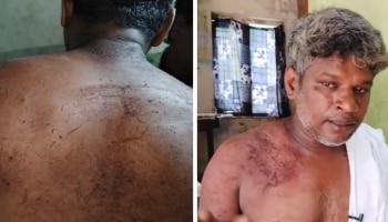 Police Beats Man: ഉത്സവഘോഷയാത്ര കഴിഞ്ഞ് മടങ്ങവെ യുവാവിന് പോലീസിന്റെ ക്രൂരമർദ്ദനം; പരാതി നൽകി