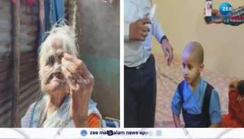 Nail loss complaints after Hair loss in Village in Maharashtra
