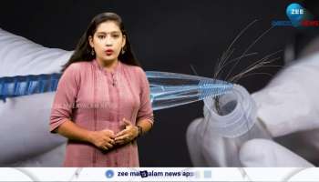 Hair follicle chemical test, what is a hair follicle test?