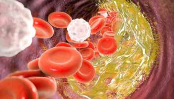 Cholestrol Control:  ചീത്ത കൊളസ്‌ട്രോള്‍ നിയന്ത്രിക്കണോ? എങ്കില്‍ ഇക്കാര്യങ്ങള്‍ അറിഞ്ഞിരിക്കണം