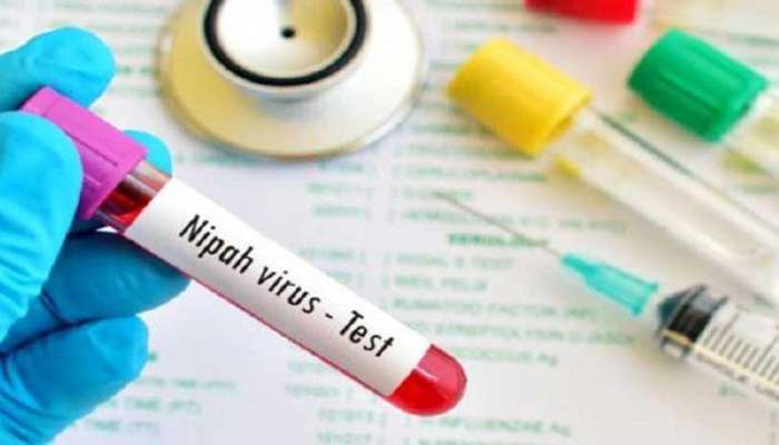 നിപാ വൈറസ്: പൂനെ വൈറോളജി ഇന്സ്റ്റിറ്റ്യൂട്ടിന്റെ പരിശോധനാ ഫലം ഇന്ന് നിപാ വൈറസ്: പൂനെ വൈറോളജി ഇന്സ്റ്റിറ്റ്യൂട്ടിന്റെ പരിശോധനാ ഫലം ഇന്ന്