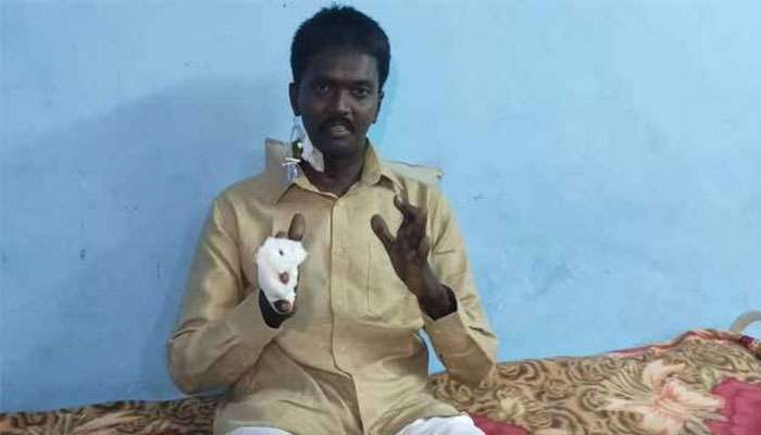 വാവ സുരേഷ് ആശുപത്രി വിട്ടു വാവ സുരേഷ് ആശുപത്രി വിട്ടു