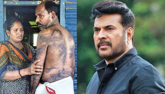 തൊഴിലുടമയുടെ പീഡനം: ഹരിദാസിന് സഹായഹസ്തവുമായി മമ്മൂട്ടിയുടെ 'പതഞ്ജലി'!! തൊഴിലുടമയുടെ പീഡനം: ഹരിദാസിന് സഹായഹസ്തവുമായി മമ്മൂട്ടിയുടെ 'പതഞ്ജലി'!!