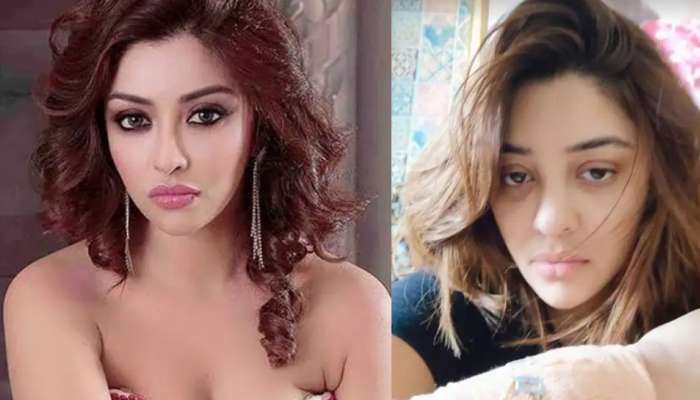 Actress Payal Ghosh : നടി പായൽ ഘോഷിന് പരിക്ക്, അജ്ഞാതരുടെ ആസിഡ് ആക്രമണമാണെന്ന് നടി