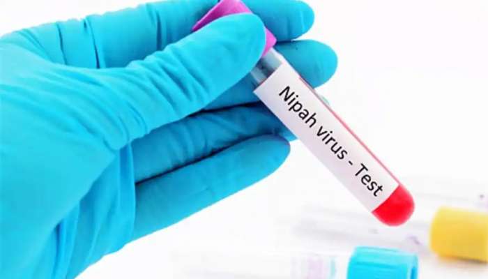 Nipah Virus: കോഴിക്കോട് നിപ ബാധിച്ച് മരിച്ച കുട്ടിയുടെ കുടുംബത്തിന് സർക്കാർ ധനസഹായം പ്രഖ്യാപിച്ചു