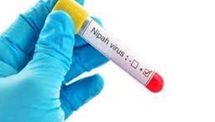 Nipah Virus : കോഴിക്കോട് വവ്വാലുകളിൽ നിപ സാന്നിധ്യം കണ്ടെത്തി; വിശദപഠനം നടത്തും