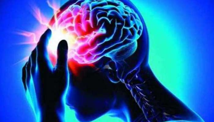 Risk of Stroke : സ്ട്രോക്ക് ഉണ്ടാകാതിരിക്കാൻ ശ്രദ്ധിക്കേണ്ട കാര്യങ്ങൾ എന്തൊക്കെ?