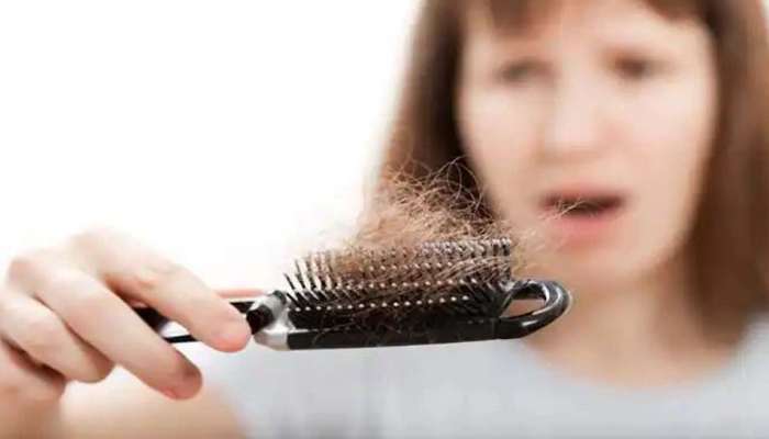 Hair Loss Solution | മുടി കൊഴിച്ചിൽ കൊണ്ട് മടുത്തോ? ഇക്കാര്യങ്ങൾ ഒന്ന് പരീക്ഷിച്ച് നോക്കു