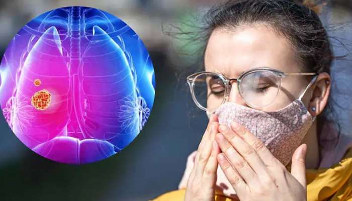 Lung Cancer : സ്ത്രീകളിൽ ശ്വാസകോശ അർബുദം വർധിക്കുന്നു; കാരണമിതാണ് 