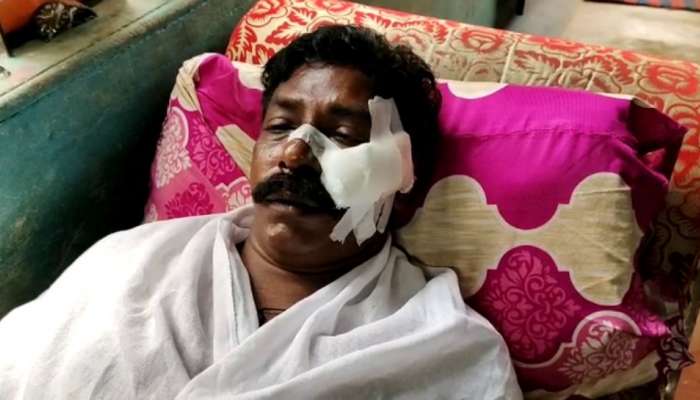 Attack on CITU Worker: വര്‍ക്കലയില്‍ സിഐടിയു പ്രവർത്തകന് വെട്ടേറ്റു; ലഹരി ഉപയോഗം തടഞ്ഞതുകൊണ്ടെന്ന് പരാതി