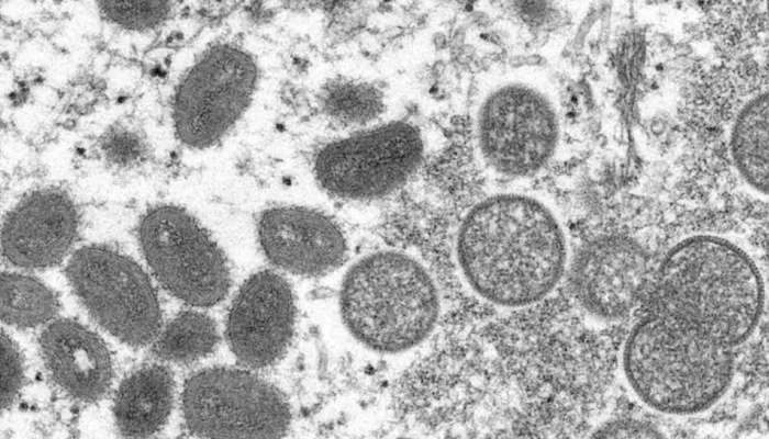 Monkeypox: മങ്കിപോക്സ് കേസുകൾ വർധിക്കുന്നു; 23 രാജ്യങ്ങളിലായി 250ൽ അധികം കേസുകൾ റിപ്പോർട്ട് ചെയ്തു