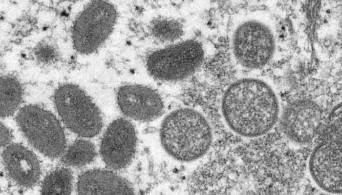 UAE Monkeypox cases: യുഎഇയിൽ നാല് മങ്കിപോക്സ് കേസുകൾ കൂടി റിപ്പോർട്ട് ചെയ്തു; ജനങ്ങൾ ജാ​ഗ്രത പാലിക്കണമെന്ന് നിർദേശം