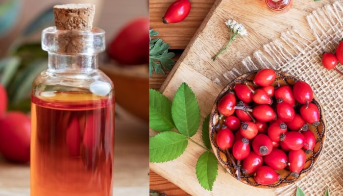 Rosehip Oil Benefits: ചർമ്മ സംരക്ഷണത്തിന് മാത്രമല്ല മുടിയിഴകളുടെ സൗന്ദര്യത്തിനും ഈ ഓയിൽ ബെസ്റ്റാണ്