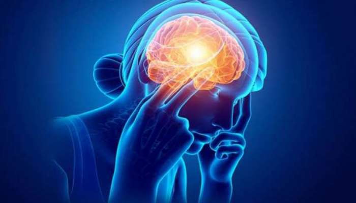 Migraine Remedies: മൈഗ്രേൻ കുറയ്ക്കാനുള്ള വഴികളും ശ്രദ്ധിക്കേണ്ട കാര്യങ്ങളും