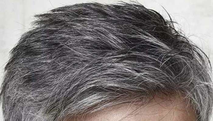Natural Remedies for Gray Hair: നരച്ച മുടിയാണോ പ്രശ്നം; ഭക്ഷണത്തിൽ ശ്രദ്ധിക്കാം