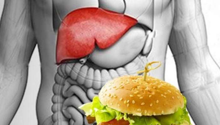 Liver Health: കരളിന്റെ ആരോ​ഗ്യത്തിന് ഈ ഭക്ഷണങ്ങൾ വെല്ലുവിളി; ഒഴിവാക്കേണ്ട ഭക്ഷണങ്ങൾ ഇവയാണ്