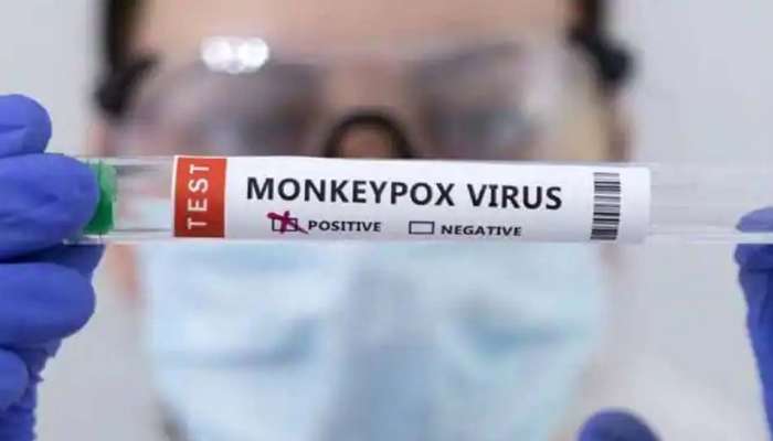  Monkeypox Case: സംസ്ഥാനത്ത് ഒരാൾക്ക് കൂടി വാനരവസൂരി  സ്ഥിരീകരിച്ചു; ആരോഗ്യനില തൃപ്തികരം