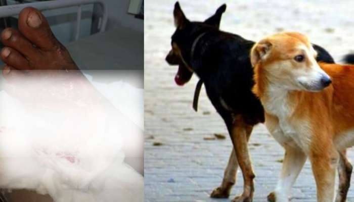 Stray dog attack: തിരുവനന്തപുരത്ത് വീണ്ടും തെരുവ് നായ ആക്രമണം; ഇരുചക്രവാഹനത്തിൽ പിന്നിലിരുന്ന ആളുടെ കാലിലെ മാംസം കടിച്ചെടുത്തു