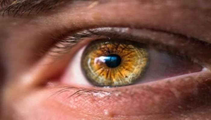 Dry Eyes Syndrome: കണ്ണുകൾ വരണ്ടതാകുന്നോ? കാരണങ്ങളും പ്രതിവിധിയും അറിയാം...