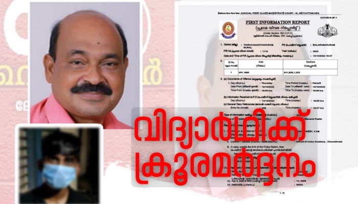 Crime: ബാലരാമപുരത്ത് വിദ്യാർഥിക്ക് ക്രൂരമർദ്ദനം; കുട്ടിയെ മർദ്ദിച്ചത് ട്യൂഷൻ സെൻ്റർ ഉടമ; പോലീസ് കേസെടുത്തു