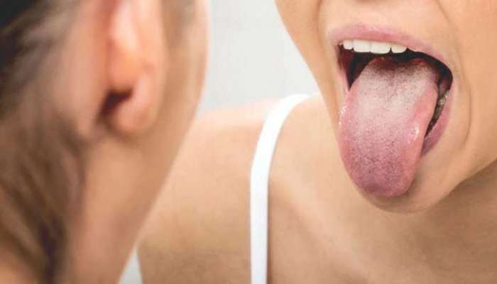 White Tongue: നാക്കുകൾ വെളുത്തിരിക്കുന്നോ, ഇക്കാരണങ്ങൾ കൊണ്ടാകാം... ശ്രദ്ധിക്കണം