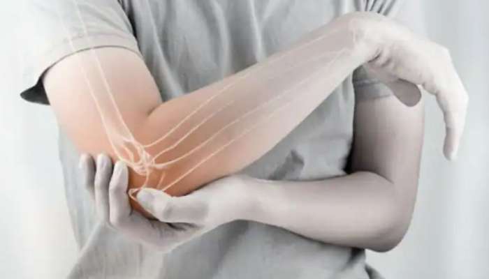 Arthritis: ശൈത്യകാലത്ത് സന്ധിവേദന ​ഗുരുതരമാകുന്നോ; ഭക്ഷണത്തിൽ ഈ മാറ്റങ്ങൾ വരുത്താം