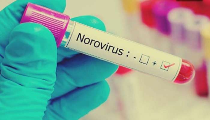 Noro Virus: എന്താണ് നോറോ വൈറസ്? രോഗ ലക്ഷണങ്ങള്‍ എന്താണ്? പകരുന്നത് എങ്ങിനെ? അറിയാം 