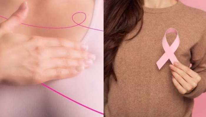  World Cancer Day: ലോക ക്യാന്‍സര്‍ ദിനം; സ്തനാർബുദത്തിന്റെ ലക്ഷണങ്ങൾ അറിയാം 