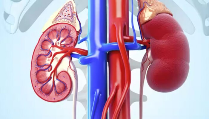 Kidney Health: നല്ല വൃക്ക വേണോ? എന്തൊക്കെ കഴിക്കാം, കഴിക്കാൻ പാടില്ല? വിശദമായി അറിയാം 