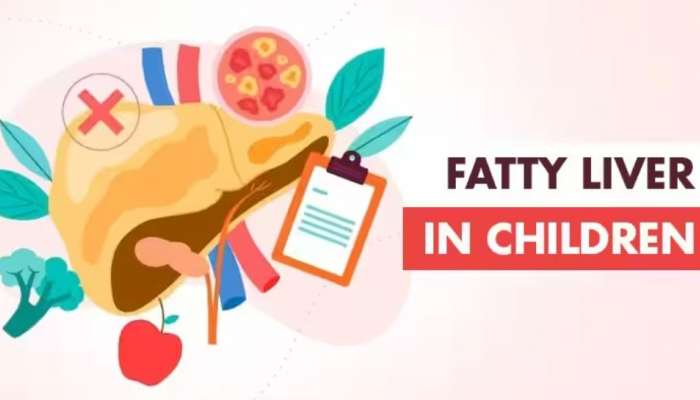 Fatty Liver In Children: കുട്ടികളിലെ ഫാറ്റി ലിവർ ശ്രദ്ധിക്കാം; അവ​ഗണിക്കരുത് ഈ ലക്ഷണങ്ങൾ