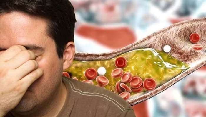 Bad Cholesterol: ഈ പാനീയങ്ങള്‍ ദിവസവും കുടിച്ചോളൂ, ചീത്ത കൊളസ്ട്രോൾ വെണ്ണ പോലെ ഉരുകും