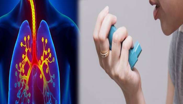 Asthma Day 2023: ആസ്മയെ പ്രതിരോധിക്കാൻ ശ്രദ്ധിക്കണം ഇക്കാര്യങ്ങൾ