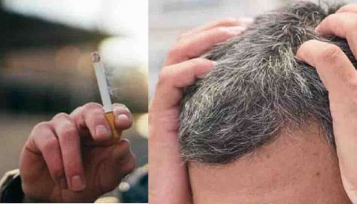 Gray Hair : പുകവലിക്കുന്നവരുടെ ശ്രദ്ധയ്ക്ക്; നിങ്ങളുടെ മുടി വേഗം നരയ്ക്കും; കാരണം ഇതാണ്